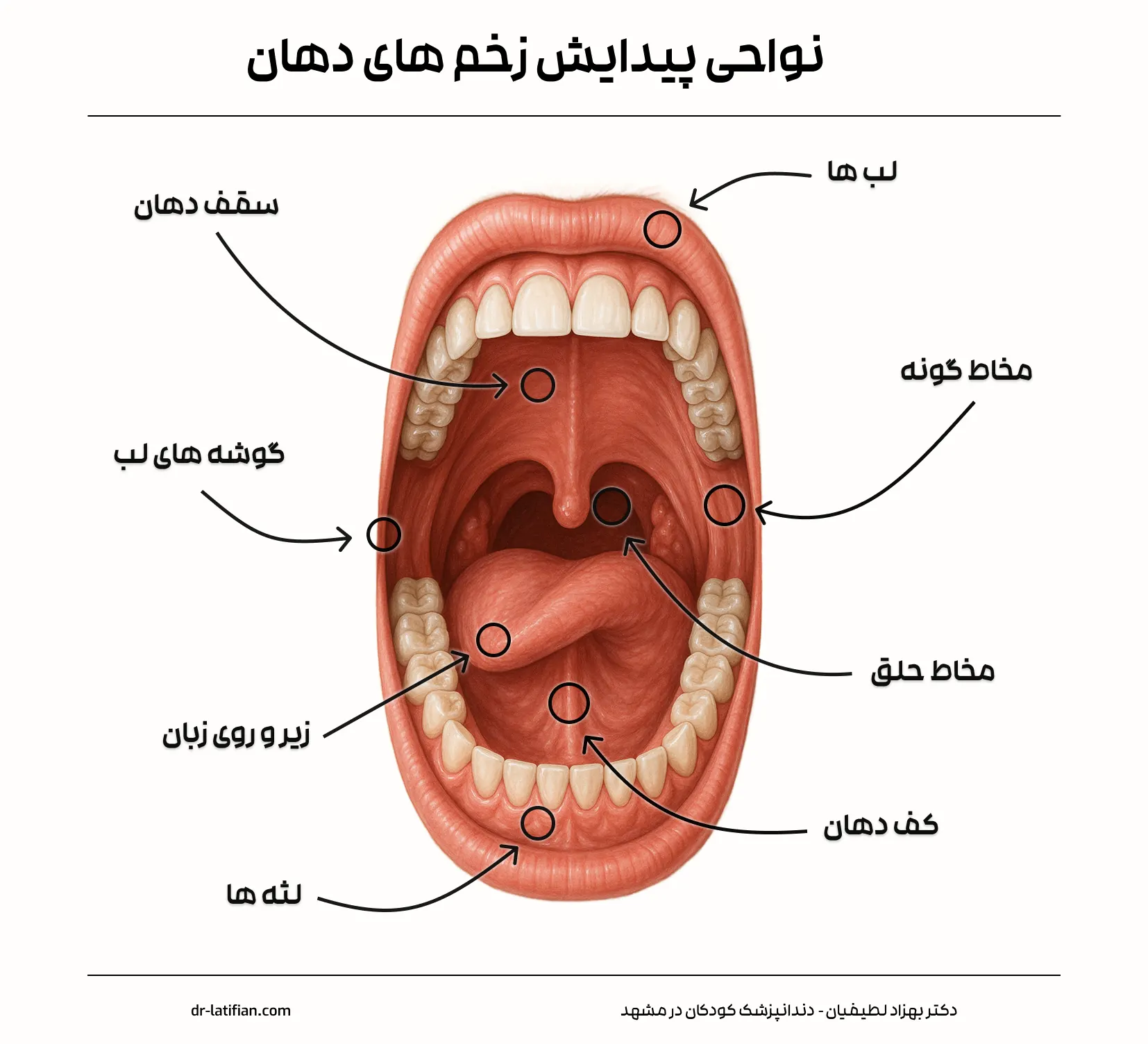 نواحی پیدایش زخم های دهان