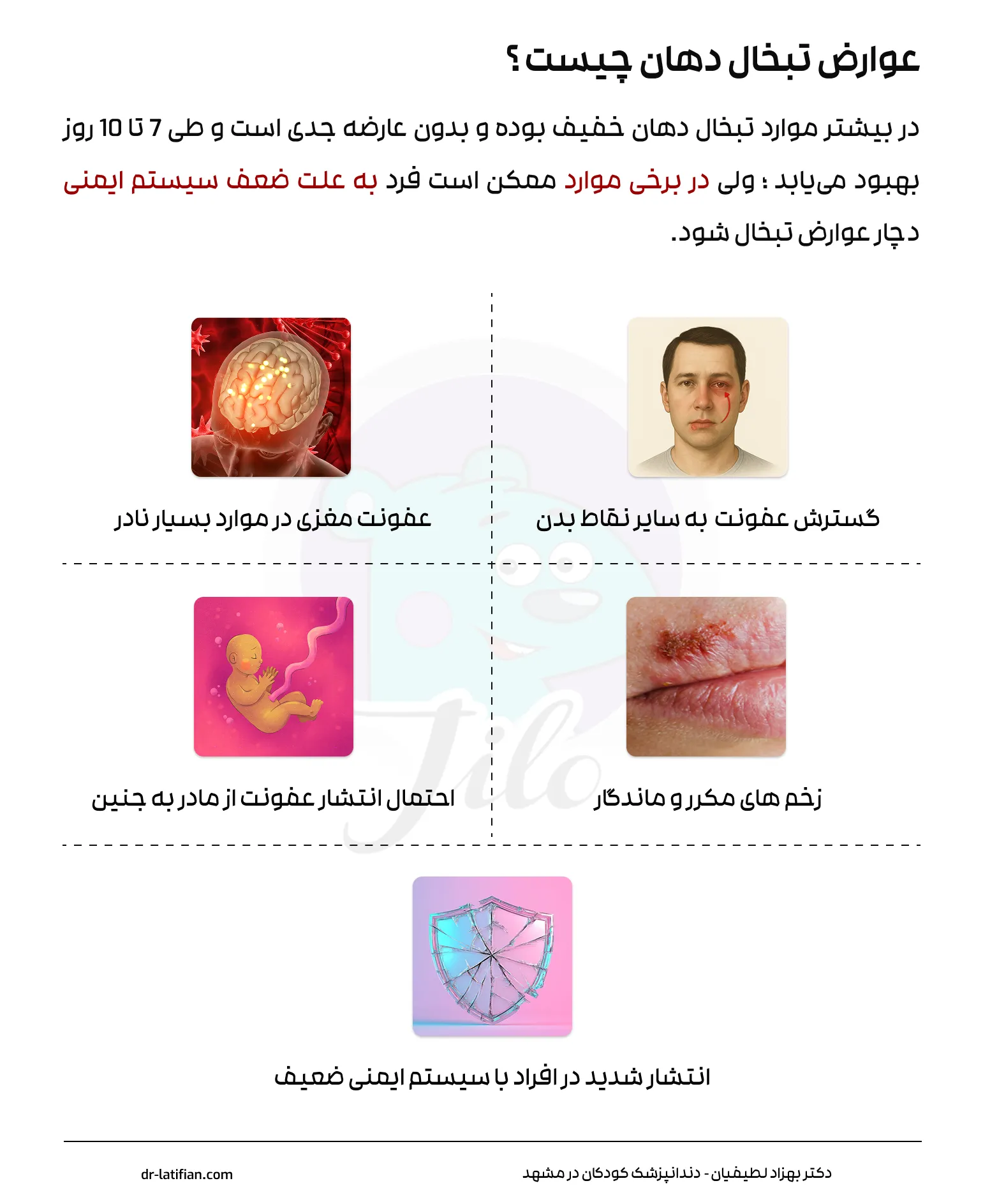 عوارض تبخال دهان