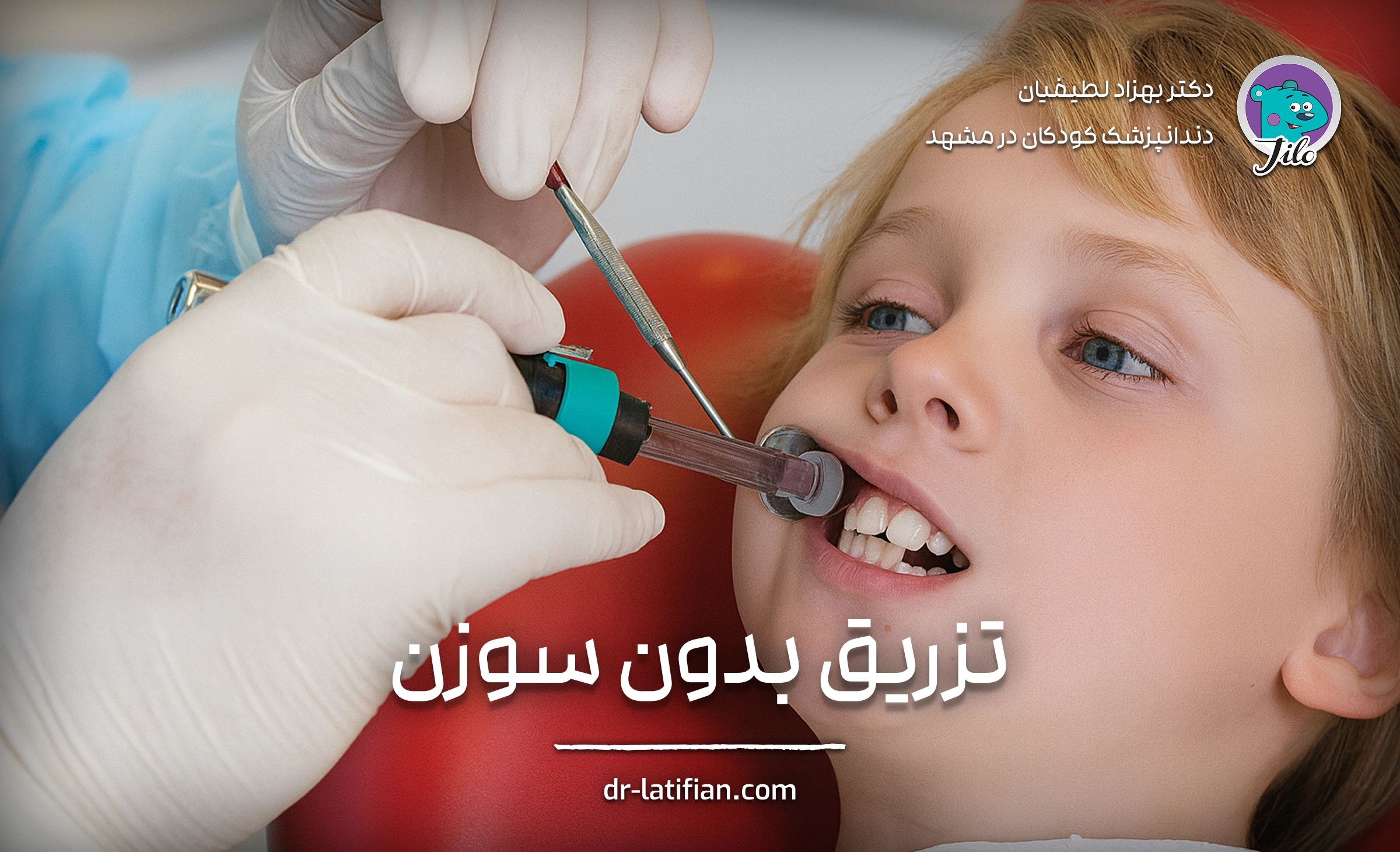سیستم تزریق بدون سوزن در دندانپزشکی کودکان با فناوری جت تزریق
