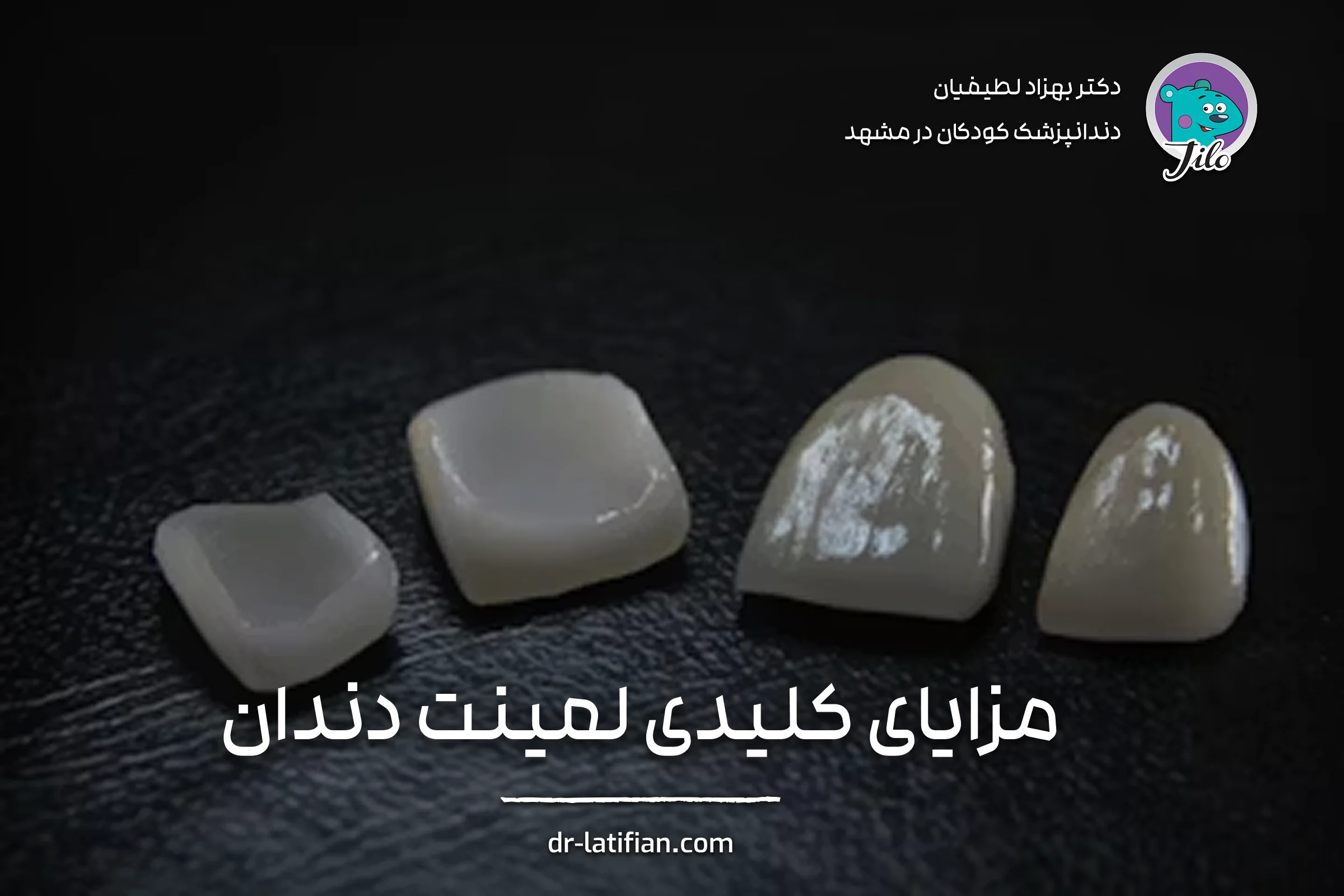 مزایای لمینت دندان سرامیکی برای لبخندی طبیعی، مقاوم و بادوام