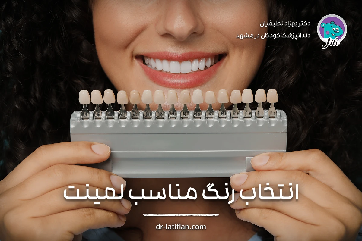 انتخاب رنگ مناسب لمینت دندان با توجه به رنگ پوست، لب و دندان طبیعی