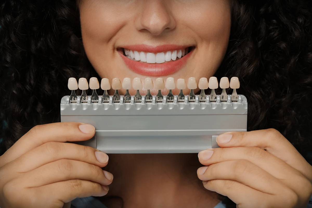 انتخاب رنگ لمینت دندان