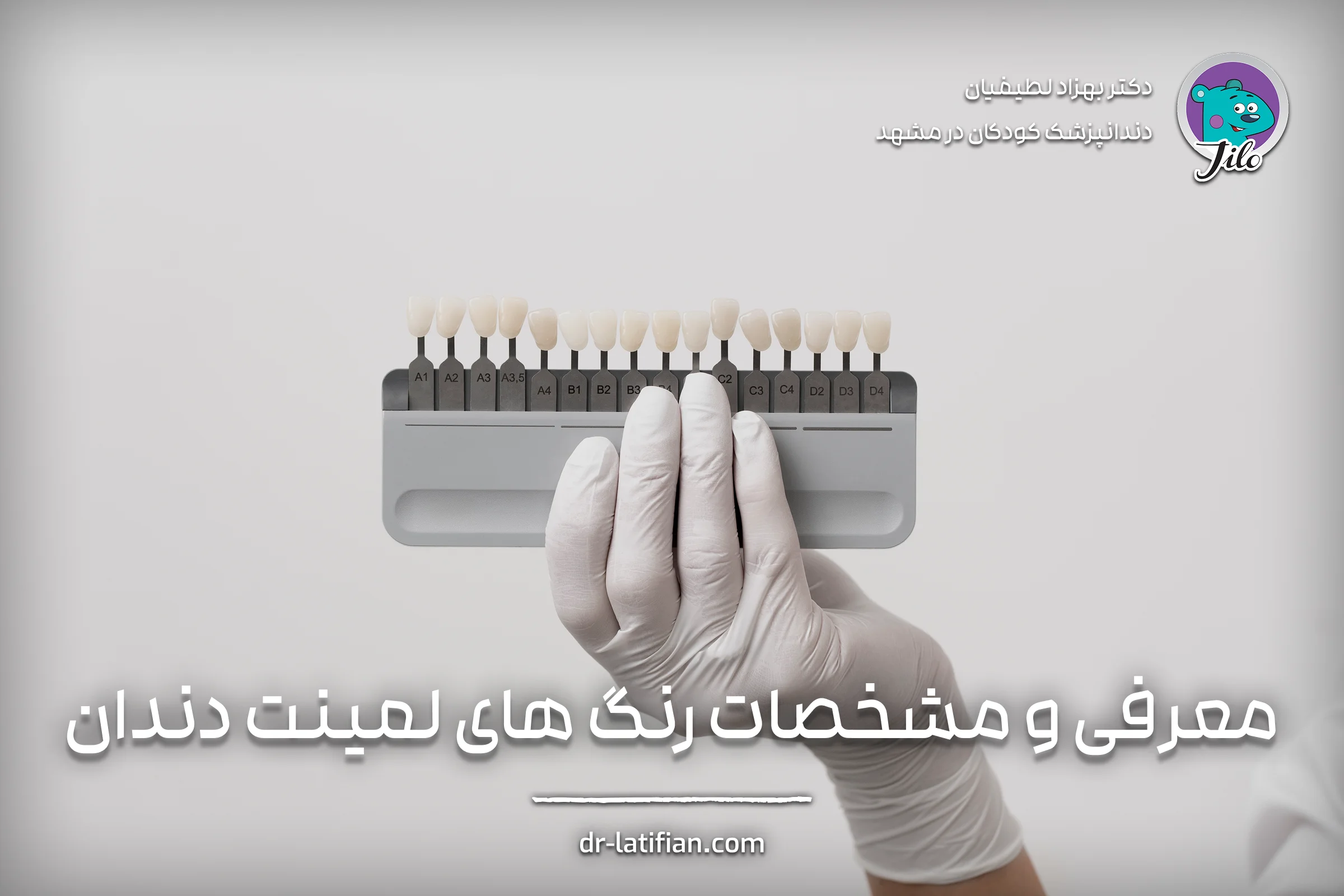 انواع رنگ‌های لمینت دندان و معرفی مشخصات هر رنگ برای لبخندی طبیعی و زیبا