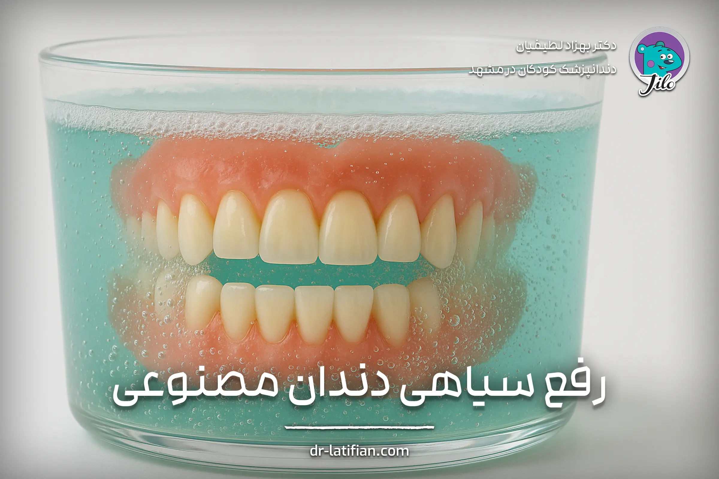 روش‌های فوری برای سفید کردن دندان مصنوعی سیاه شده با مواد خانگی و محلول‌های تخصصی