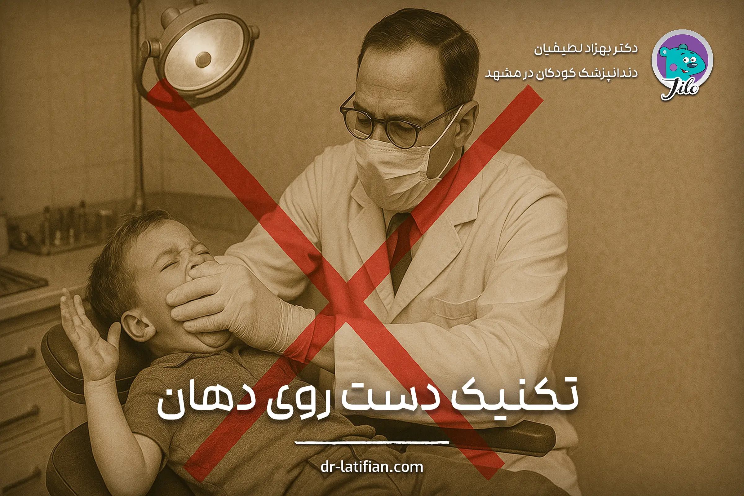 تکنیک دست روی دهان (Hand-Over-Mouth) در دندانپزشکی کودکان