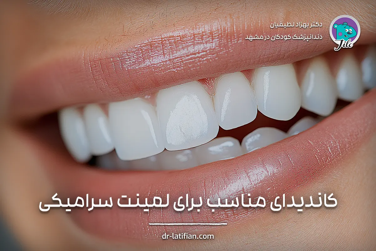 کاندیدای مناسب برای لمینت سرامیکی؛ ویژگی‌های دندان، لثه و شرایط ایده‌آل برای نصب ونیر