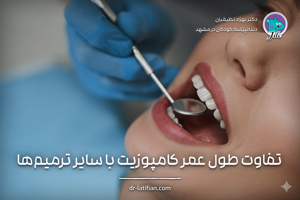 تفاوت طول عمر کامپوزیت دندان با لمینت سرامیکی و روکش دندان؛ مقایسه ماندگاری روش‌های ترمیم لبخند