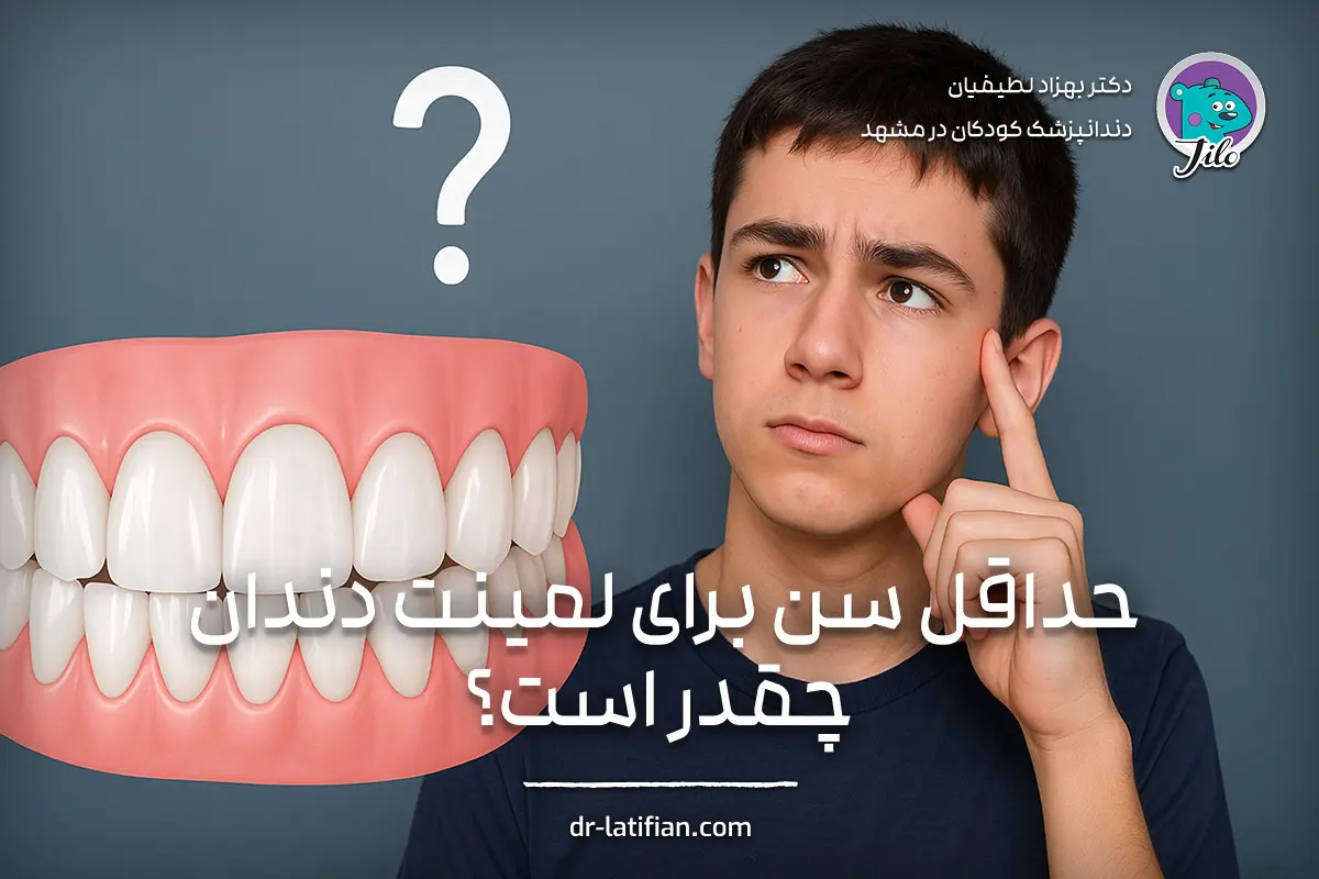 حداقل سن مناسب برای لمینت دندان و شرایط استثنایی انجام لمینت در نوجوانان