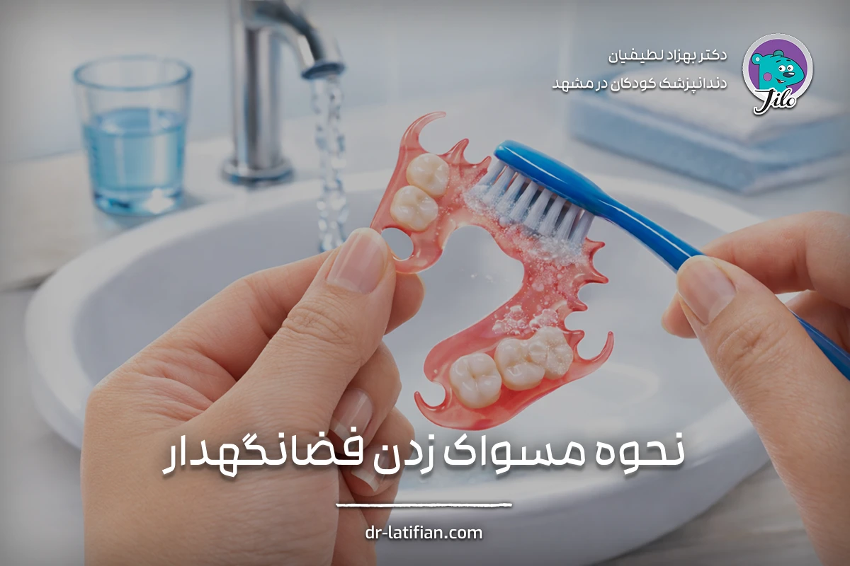 مسواک زدن صحیح کودک در اطراف فضانگهدار ثابت برای جلوگیری از تجمع پلاک