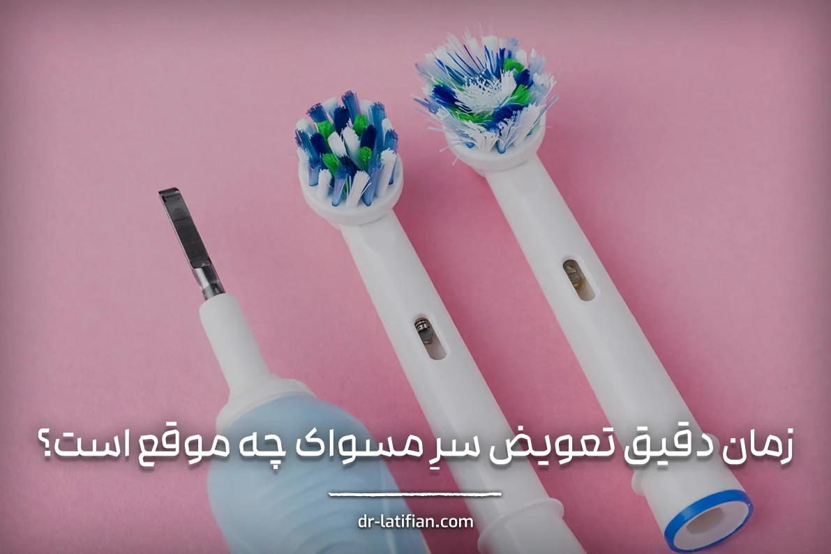 زمان مناسب تعویض سر مسواک برقی برای جلوگیری از تجمع باکتری و آسیب به لثه