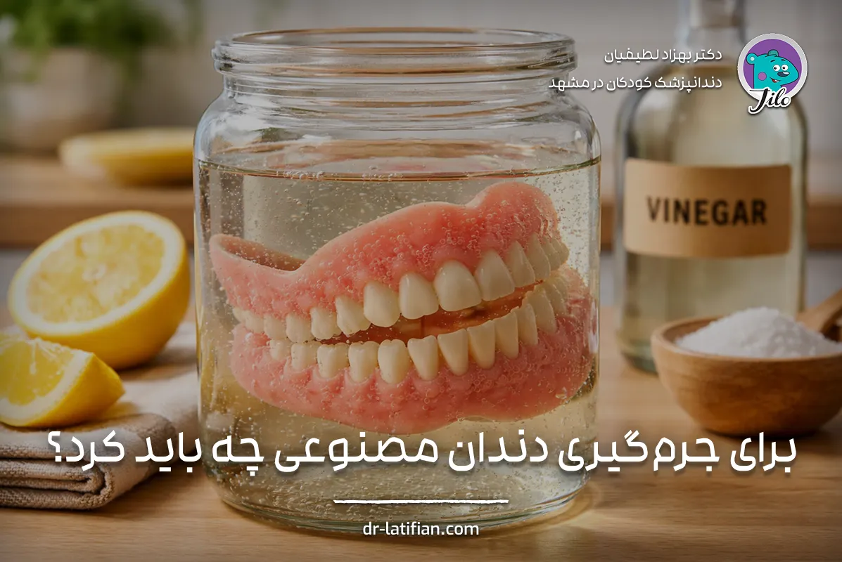 روش‌های جرم‌گیری دندان مصنوعی با قرص پاک‌کننده، سرکه سفید و دستگاه اولتراسونیک در کلینیک