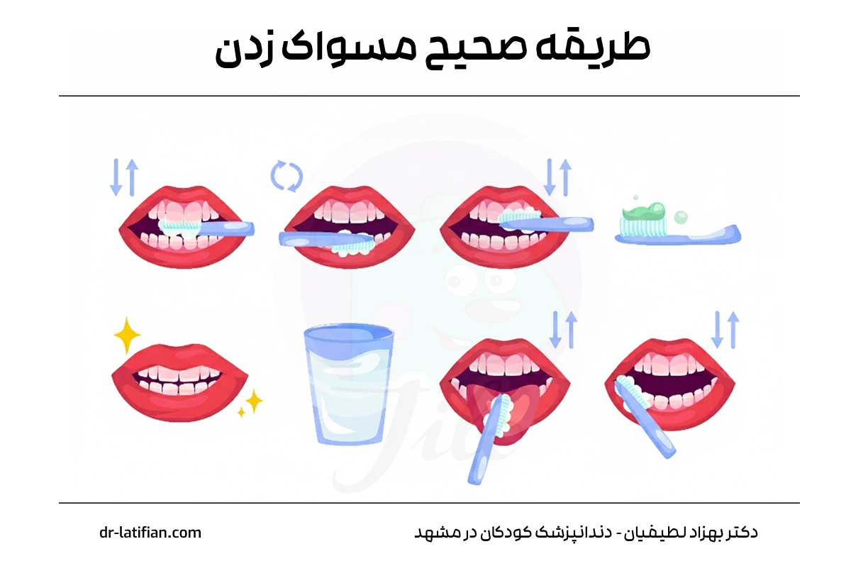طریقه صحیح مسواک زدن کودکان با زاویه ۴۵ درجه و حرکت چرخشی مسواک