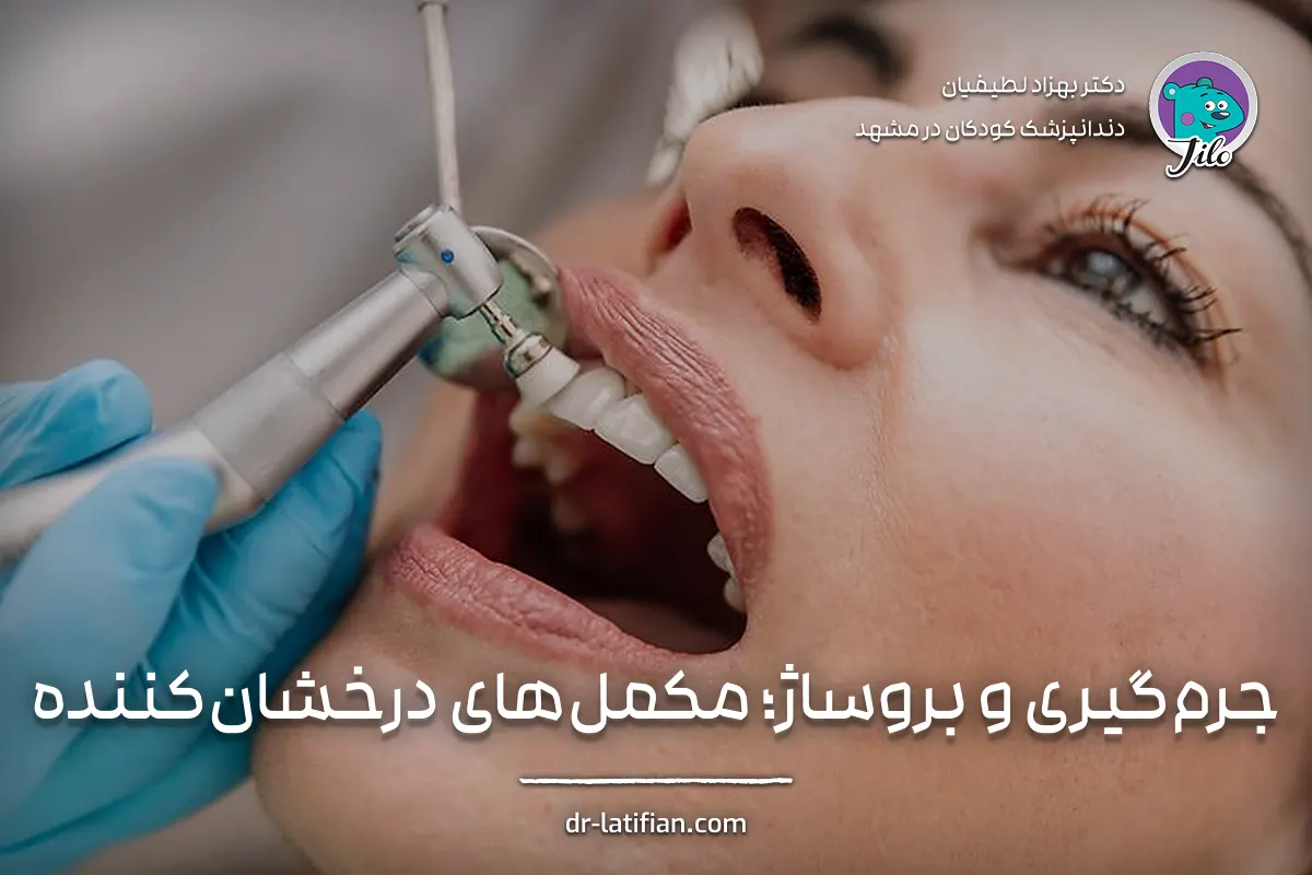 جرم‌گیری و بروساژ دندان برای حذف جرم، صیقلی کردن سطح دندان و افزایش درخشندگی لبخند