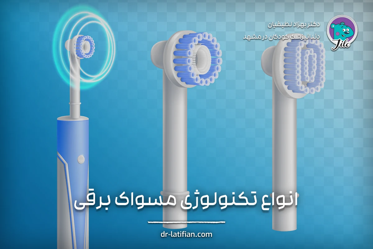 مقایسه تکنولوژی مسواک برقی سونیک (لرزشی) و چرخشی برای انتخاب بهترین گزینه بر اساس حساسیت لثه