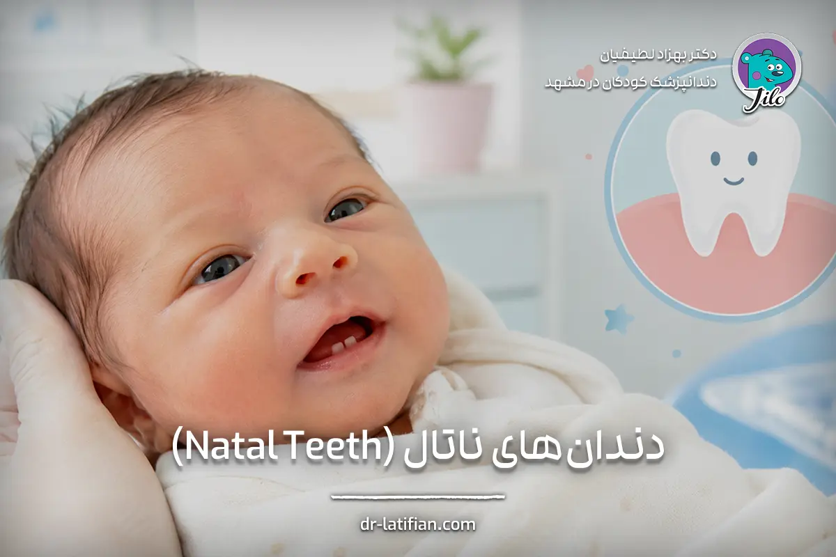 دندان ناتال یا دندان بدو تولد در نوزاد و ضرورت بررسی توسط دندانپزشک اطفال