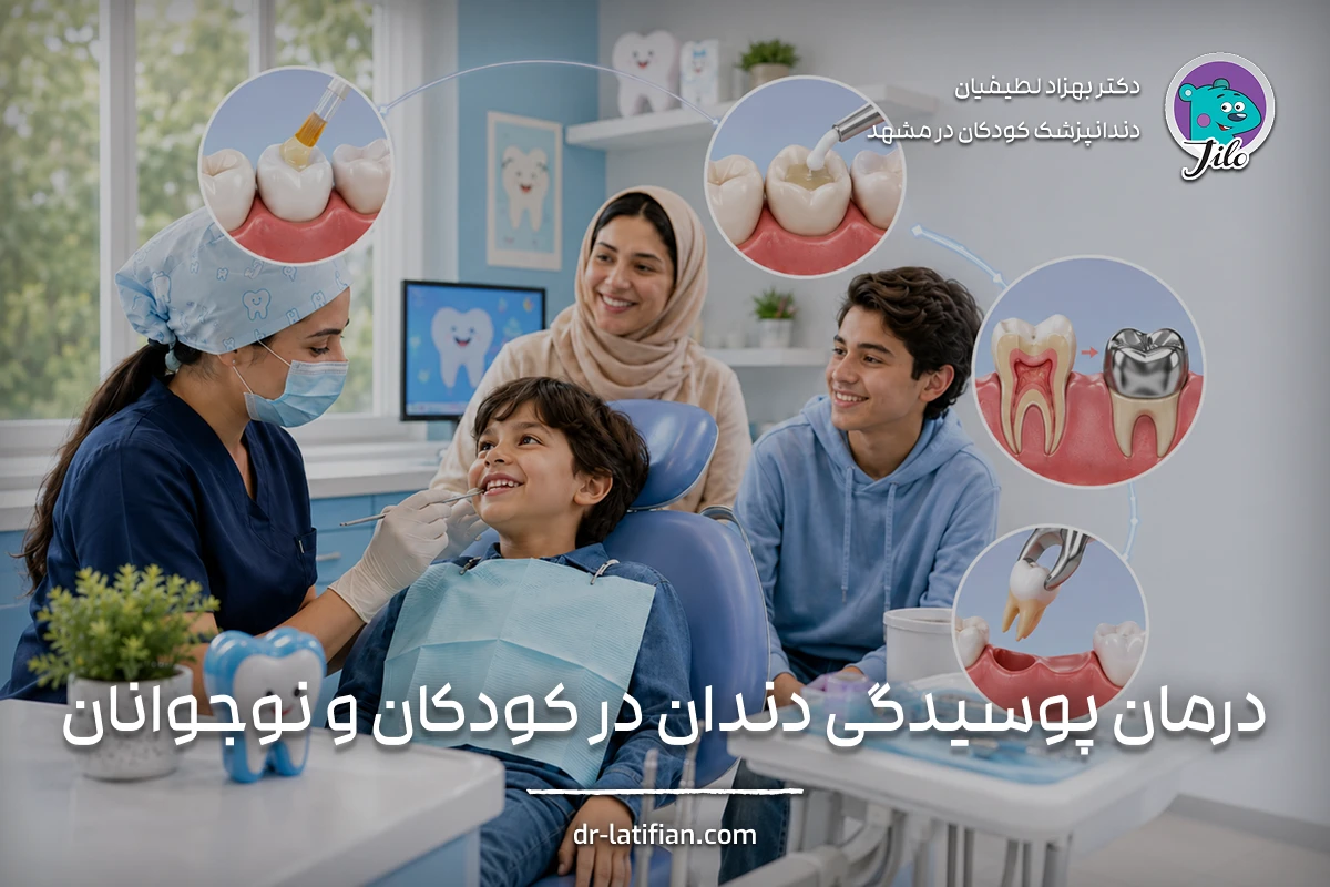 درمان پوسیدگی دندان کودکان و نوجوانان با فلورایدتراپی، ترمیم، عصب‌کشی و فضانگهدار