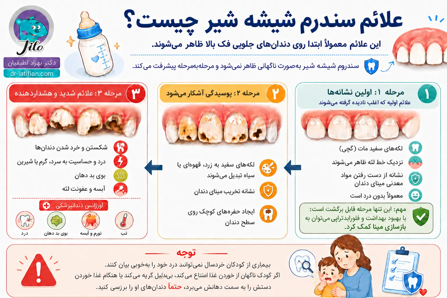 پیشگیری از سندرم شیشه شیر با رعایت بهداشت دهان و تغذیه صحیح کودک