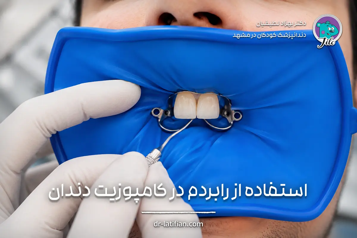 استفاده از رابردم در کامپوزیت دندان برای ایزوله کردن محیط درمان