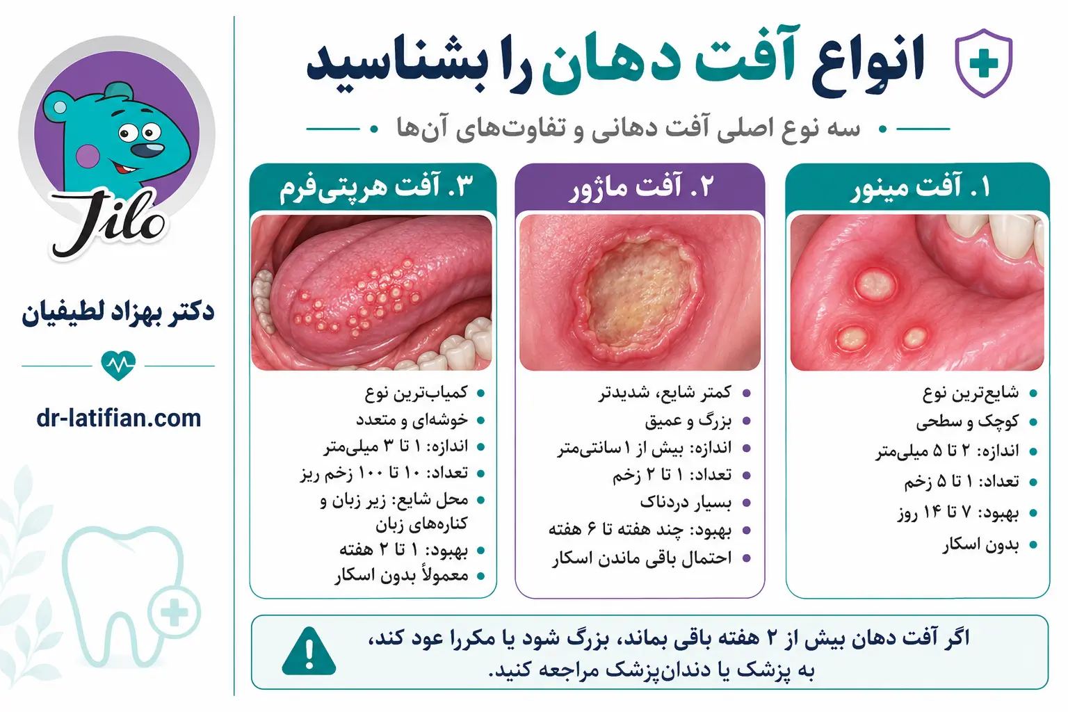 انواع آفت دهان شامل آفت مینور، آفت ماژور و آفت هرپتی‌فرم با تفاوت در اندازه، تعداد و مدت بهبودی