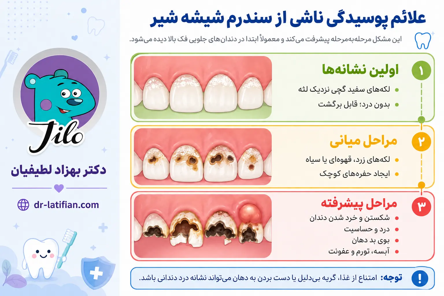 علائم پوسیدگی ناشی از سندرم شیشه شیر شامل لکه‌های سفید، لکه‌های قهوه‌ای، حفره دندان، درد، بوی بد دهان و آبسه