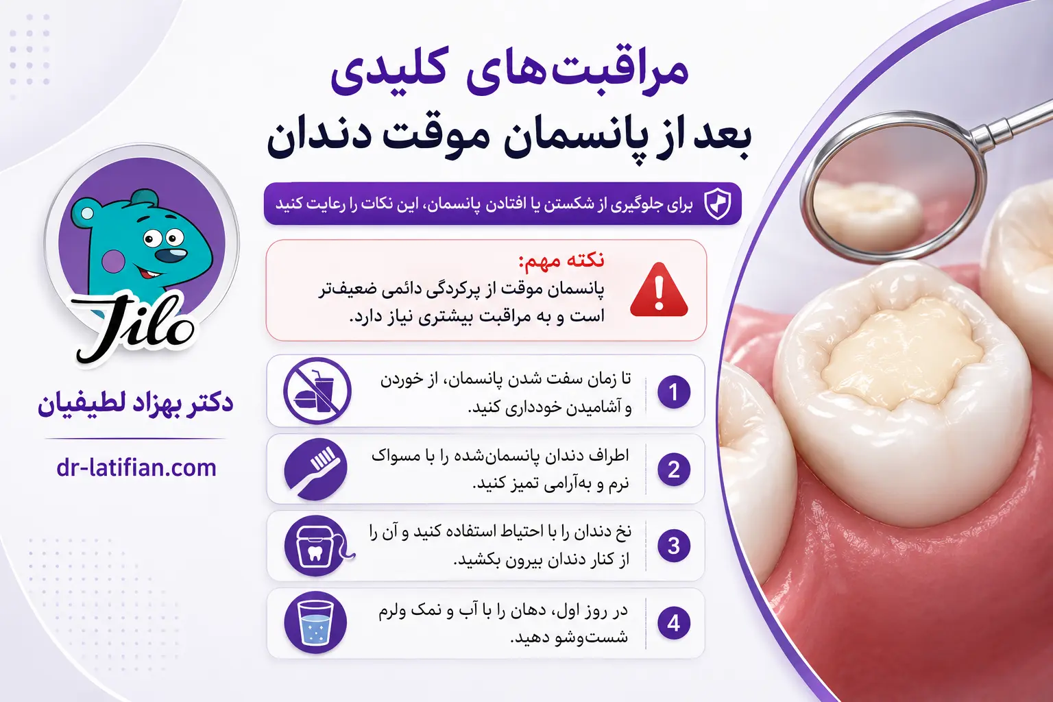 مراقبت بعد از پانسمان موقت دندان با مسواک نرم، نخ دندان صحیح و پرهیز از فشار برای جلوگیری از شکستن یا افتادن پانسمان