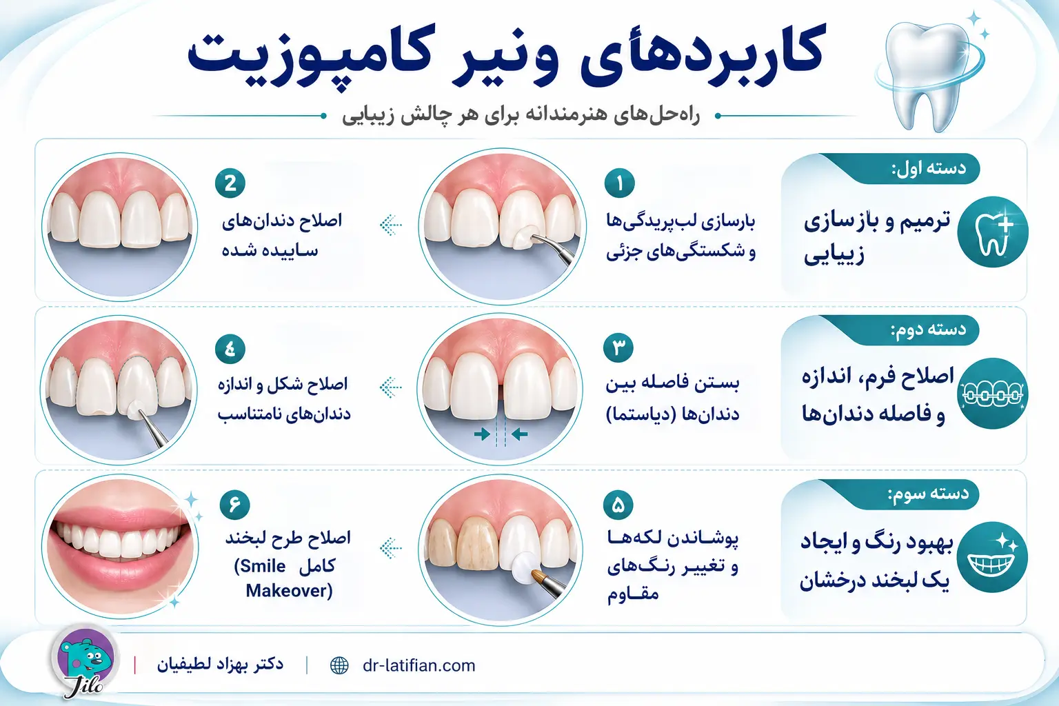 کاربردهای ونیر کامپوزیت برای ترمیم زیبایی، اصلاح فرم، بستن فاصله و بهبود رنگ دندان‌ها
