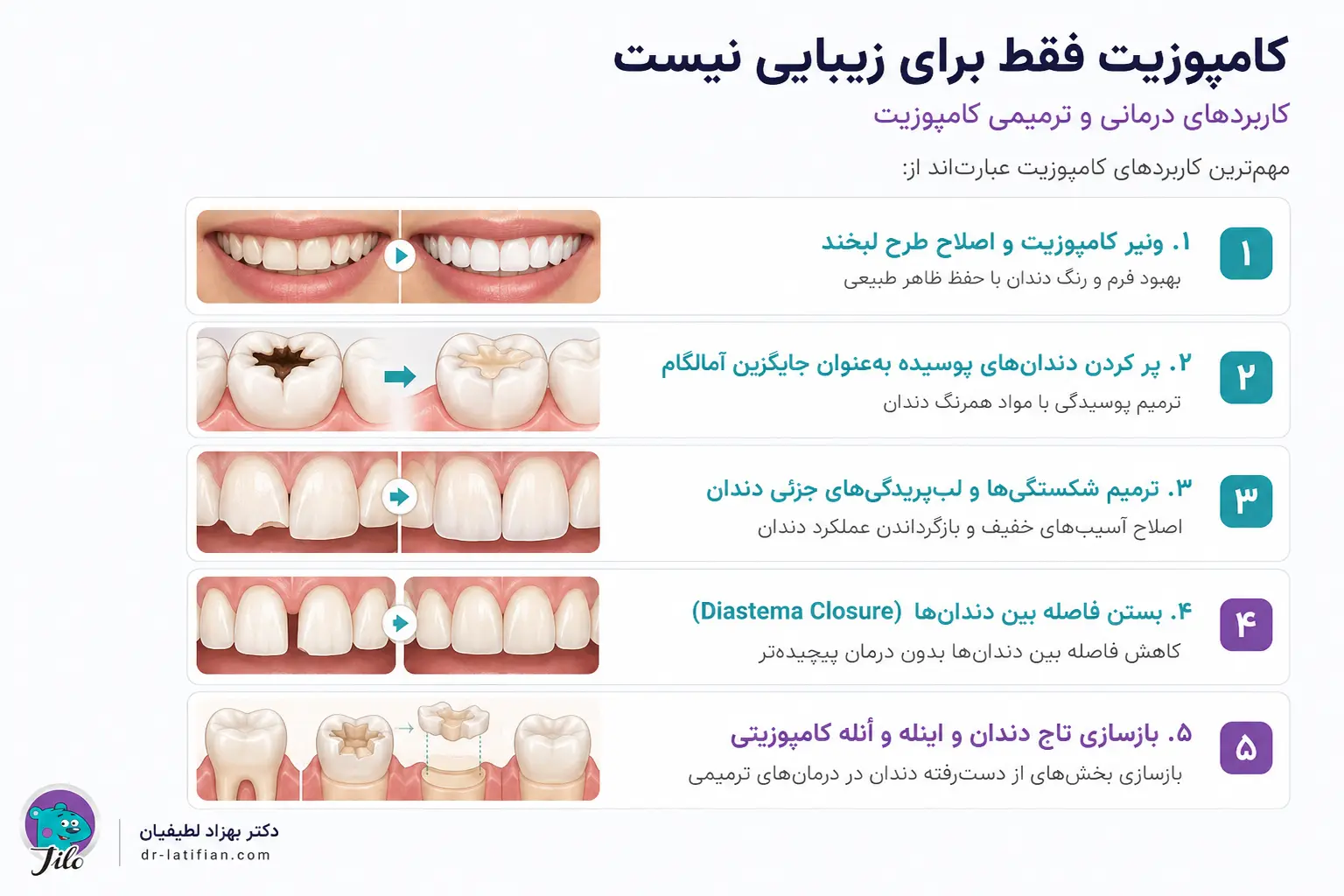 کاربردهای درمانی و ترمیمی کامپوزیت دندان فراتر از زیبایی لبخند
