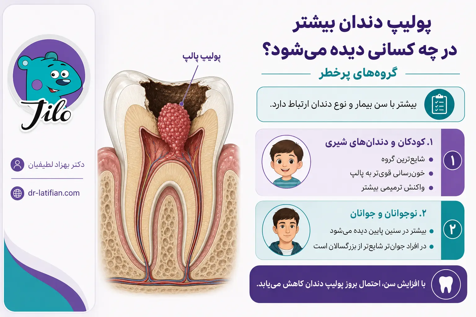پولیپ دندان در کودکان، دندان‌های شیری و افراد جوان به دلیل خون‌رسانی بالاتر پالپ و پوسیدگی عمیق
