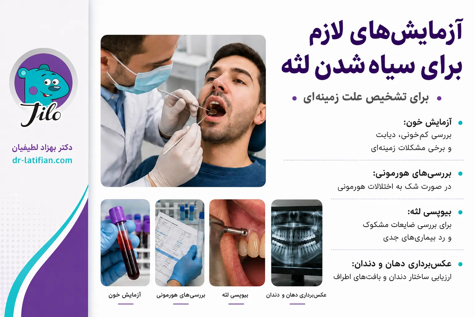 آزمایش‌های تشخیص سیاهی لثه شامل آزمایش خون، بررسی هورمونی، بیوپسی بافت لثه و عکس‌برداری دندان