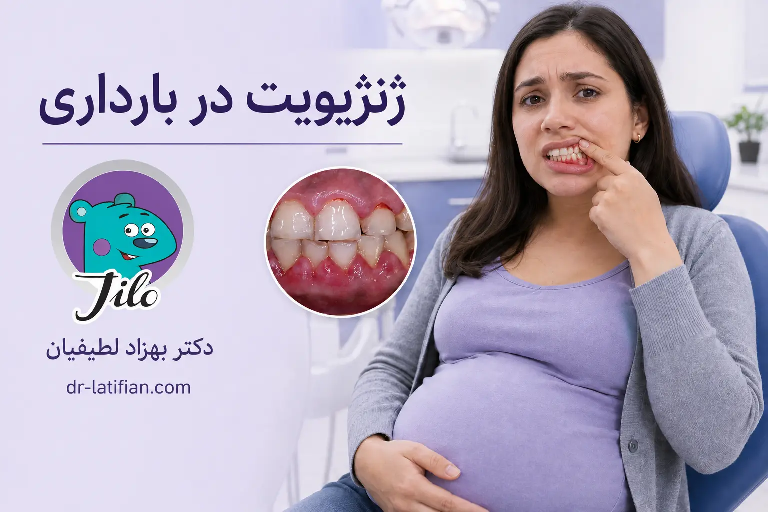 ژنژیویت بارداری و علائم التهاب لثه در دوران بارداری شامل قرمزی، تورم و خونریزی لثه