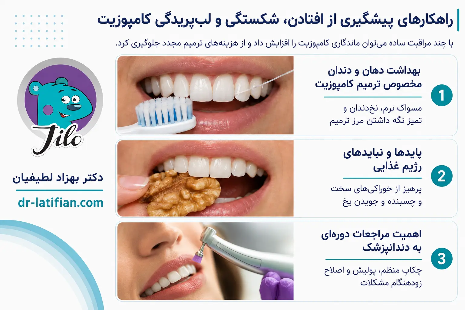 راهکارهای پیشگیری از افتادن و شکستگی کامپوزیت دندان شامل رعایت بهداشت، رژیم غذایی مناسب و مراجعات دوره‌ای به دندانپزشک