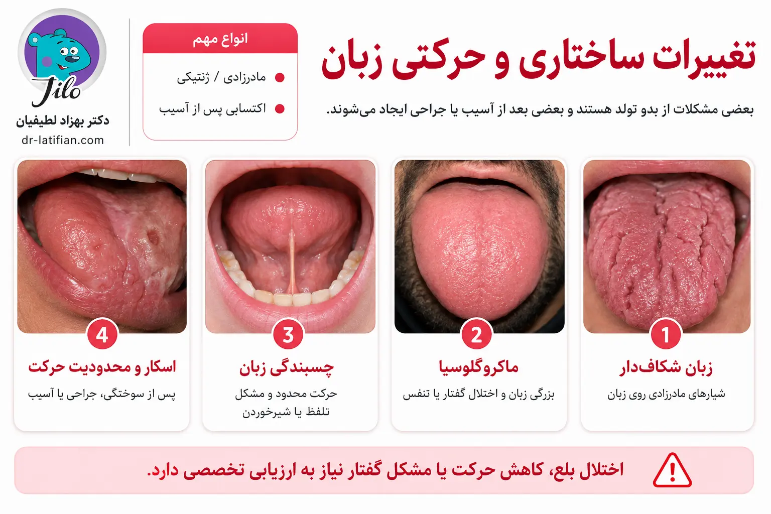 تغییرات ساختاری و حرکتی زبان شامل زبان شکاف‌دار، ماکروگلوسیا، آنکیلوگلوسیا و محدودیت حرکت زبان