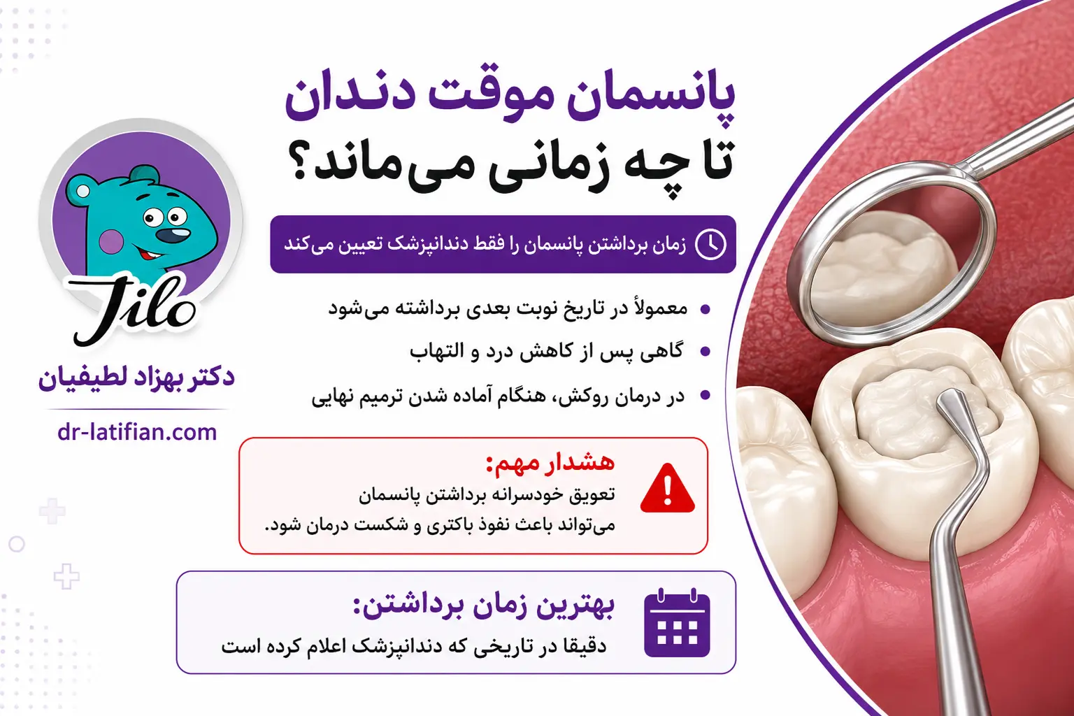 دوام پانسمان موقت دندان و زمان برداشتن آن طبق نظر دندانپزشک و برنامه درمان
