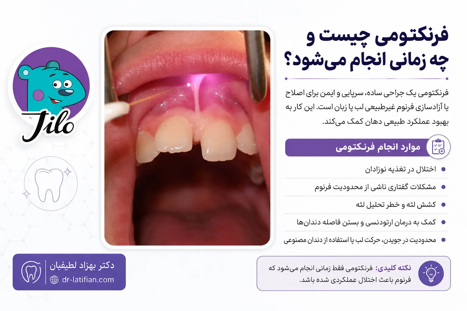 فرنکتومی برای آزادسازی فرنوم کوتاه لب یا زبان و رفع محدودیت حرکتی