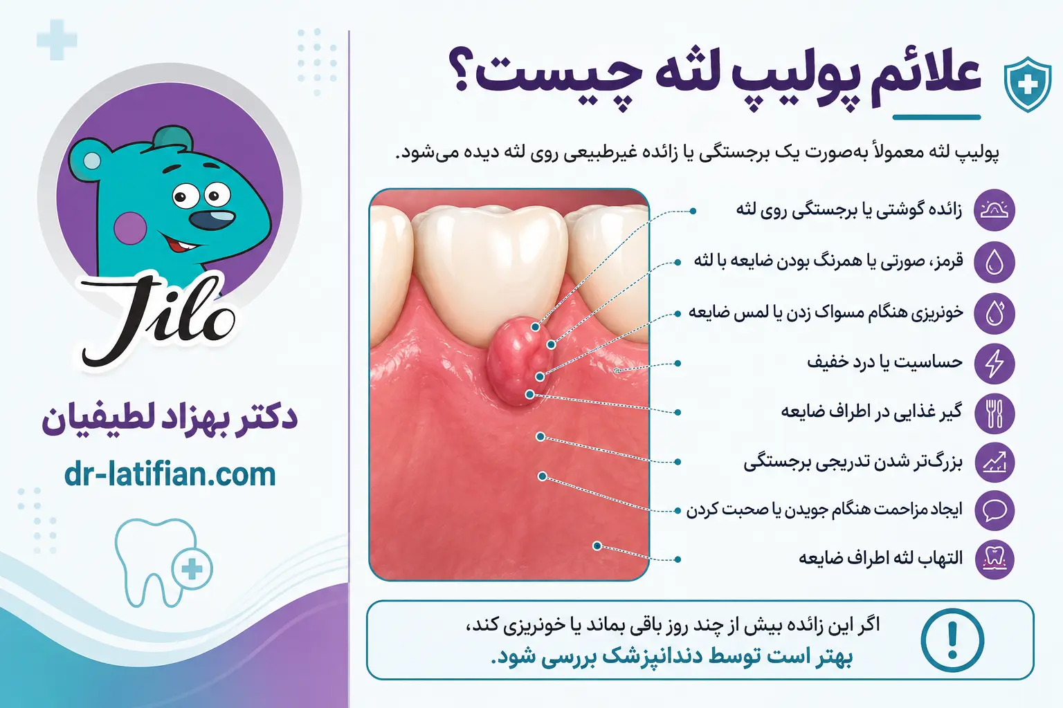 علائم پولیپ لثه و زائده گوشتی روی لثه