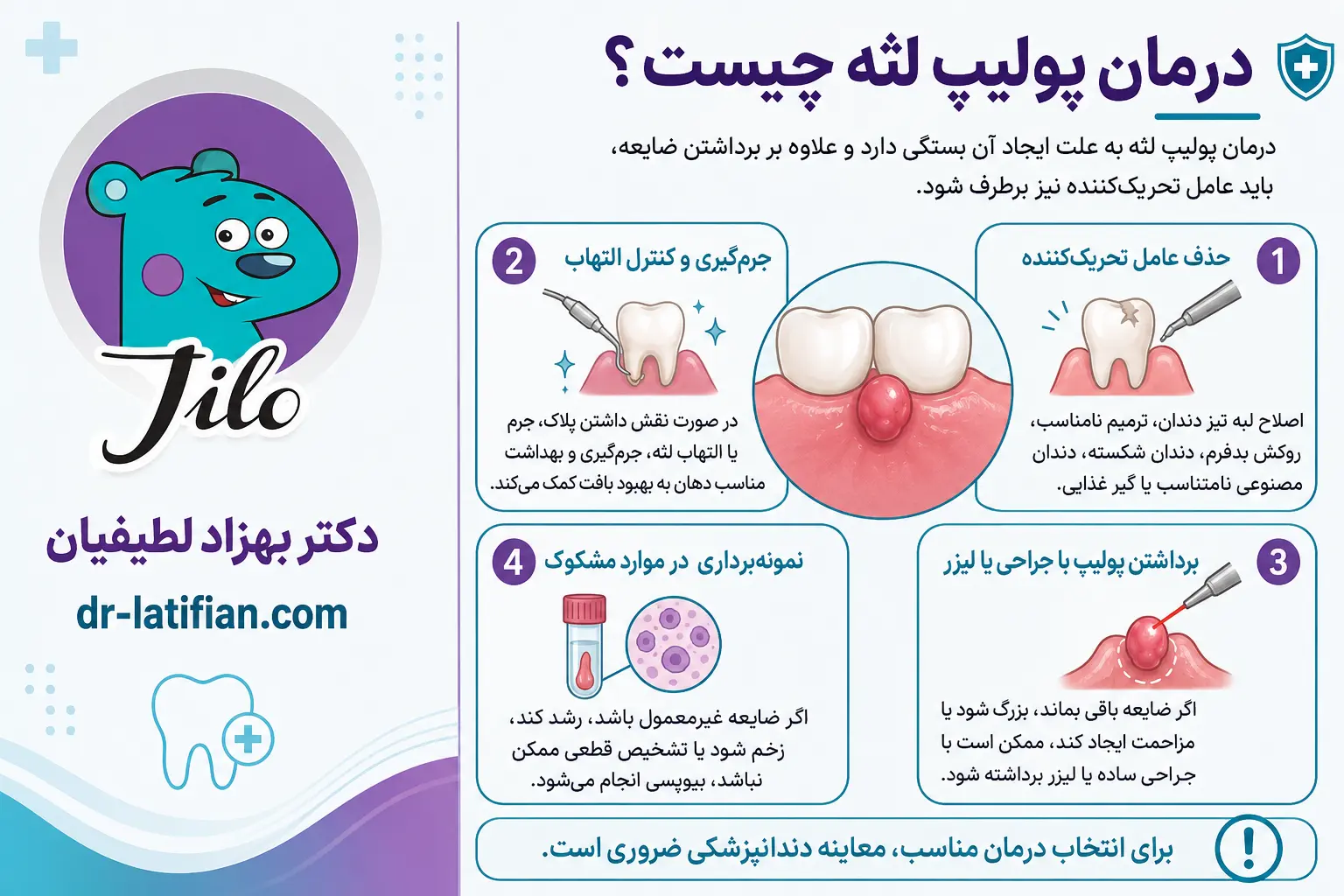 درمان پولیپ لثه با حذف عامل تحریک‌کننده، جرم‌گیری یا جراحی
