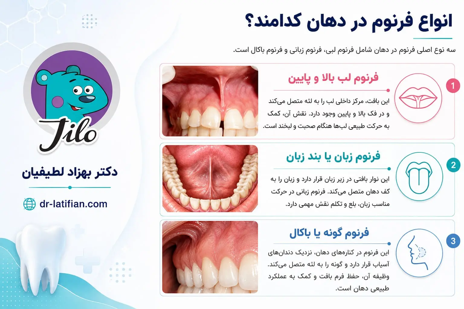 انواع فرنوم در دهان شامل فرنوم لبی، فرنوم زبانی و فرنوم باکال