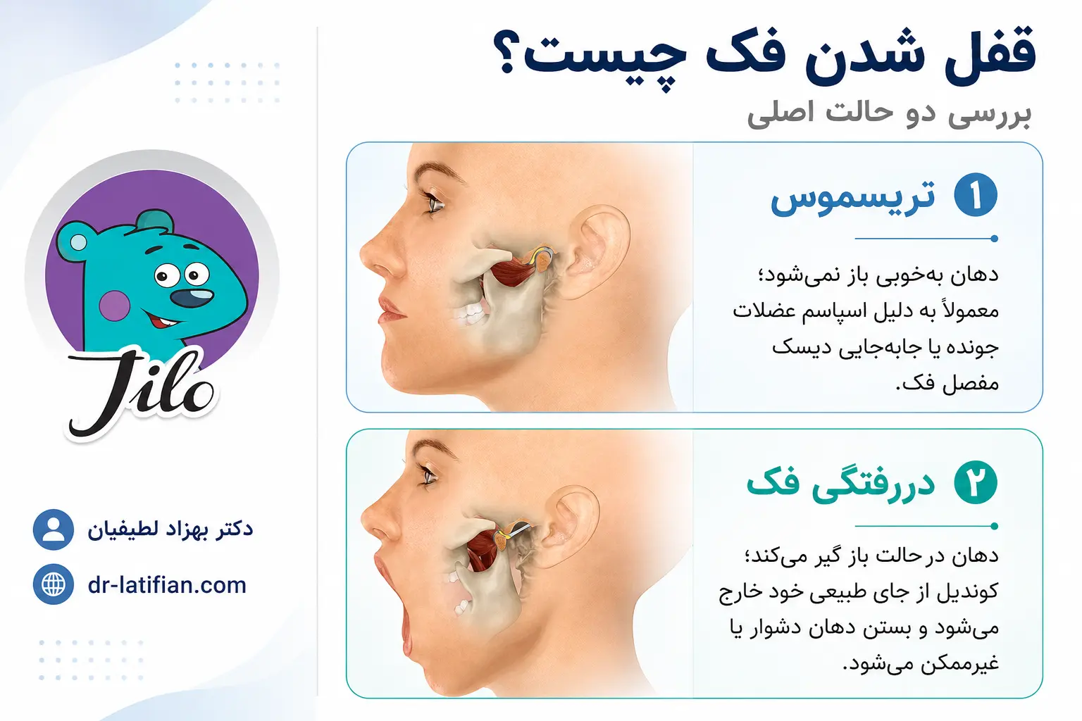 انواع قفل شدن فک شامل محدودیت باز شدن دهان و گیر کردن فک در حالت باز
