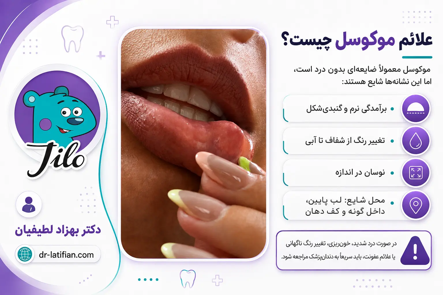 علائم موکوسل به شکل برجستگی نرم و آبی‌رنگ داخل لب پایین