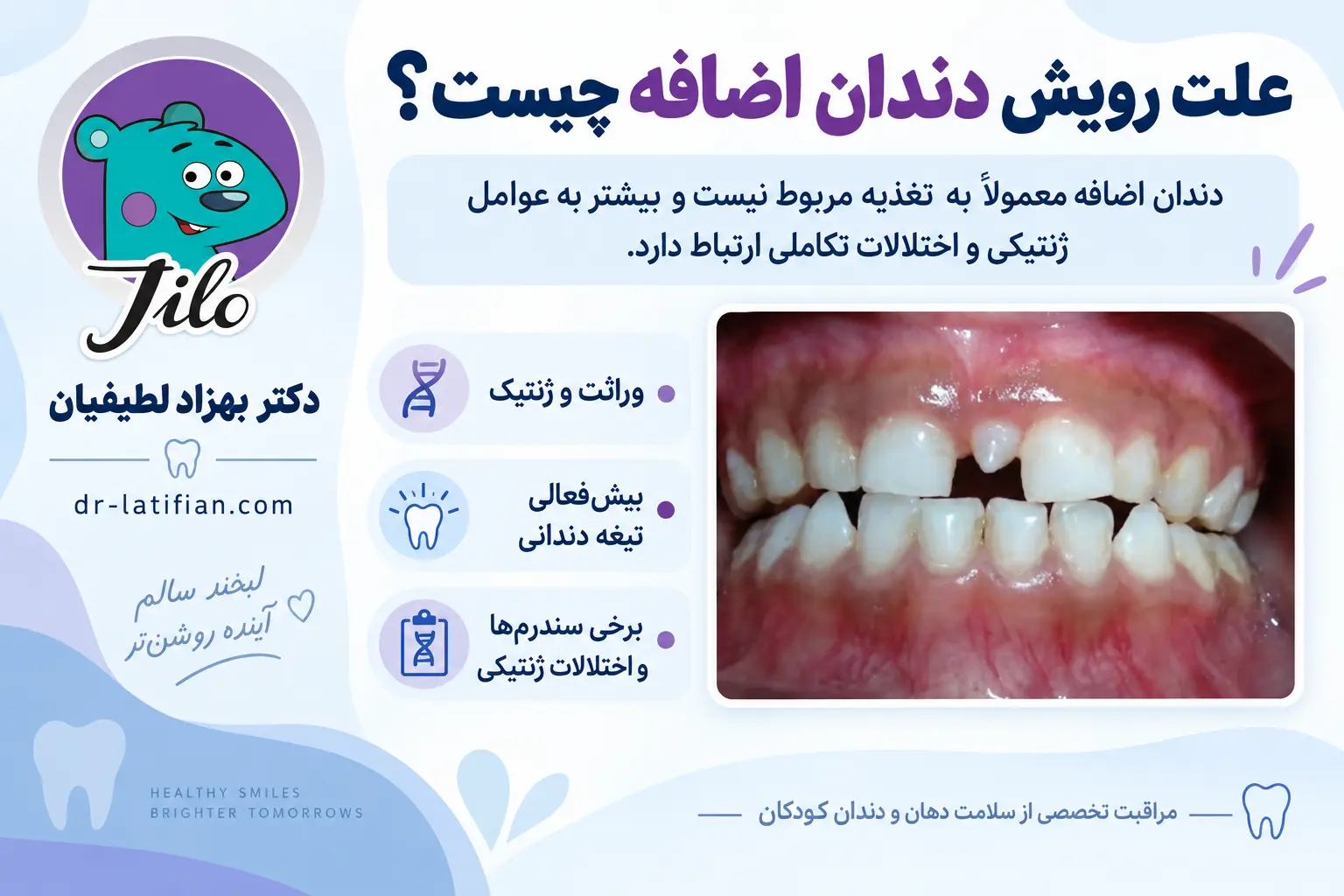 علت ایجاد دندان اضافه شامل عوامل ژنتیکی، بیش‌فعالی تیغه دندانی و برخی سندرم‌ها