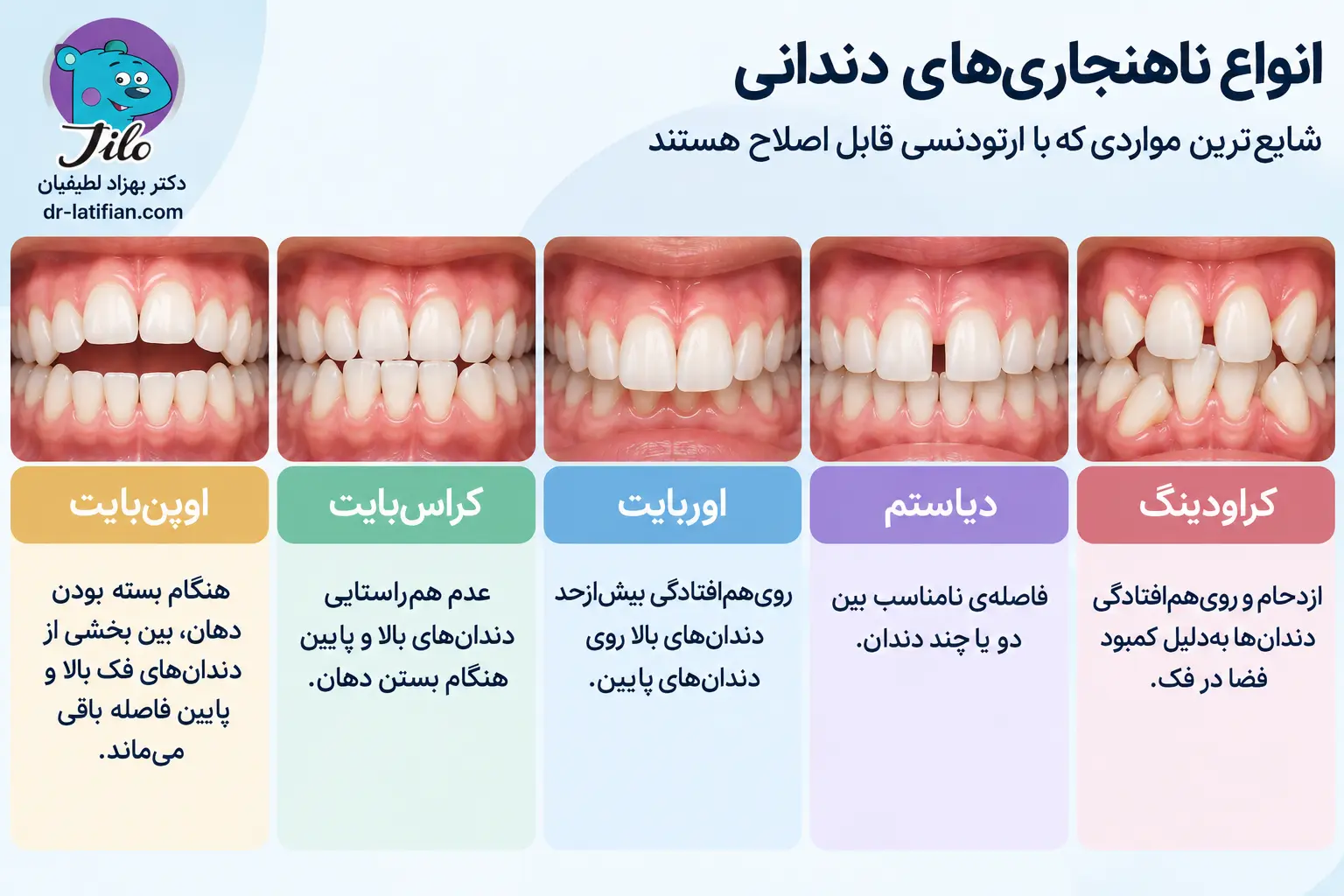 انواع ناهنجاری‌های دندانی قابل درمان با ارتودنسی شامل کراودینگ، دیاستم، اوربایت، کراس‌بایت و اوپن‌بایت