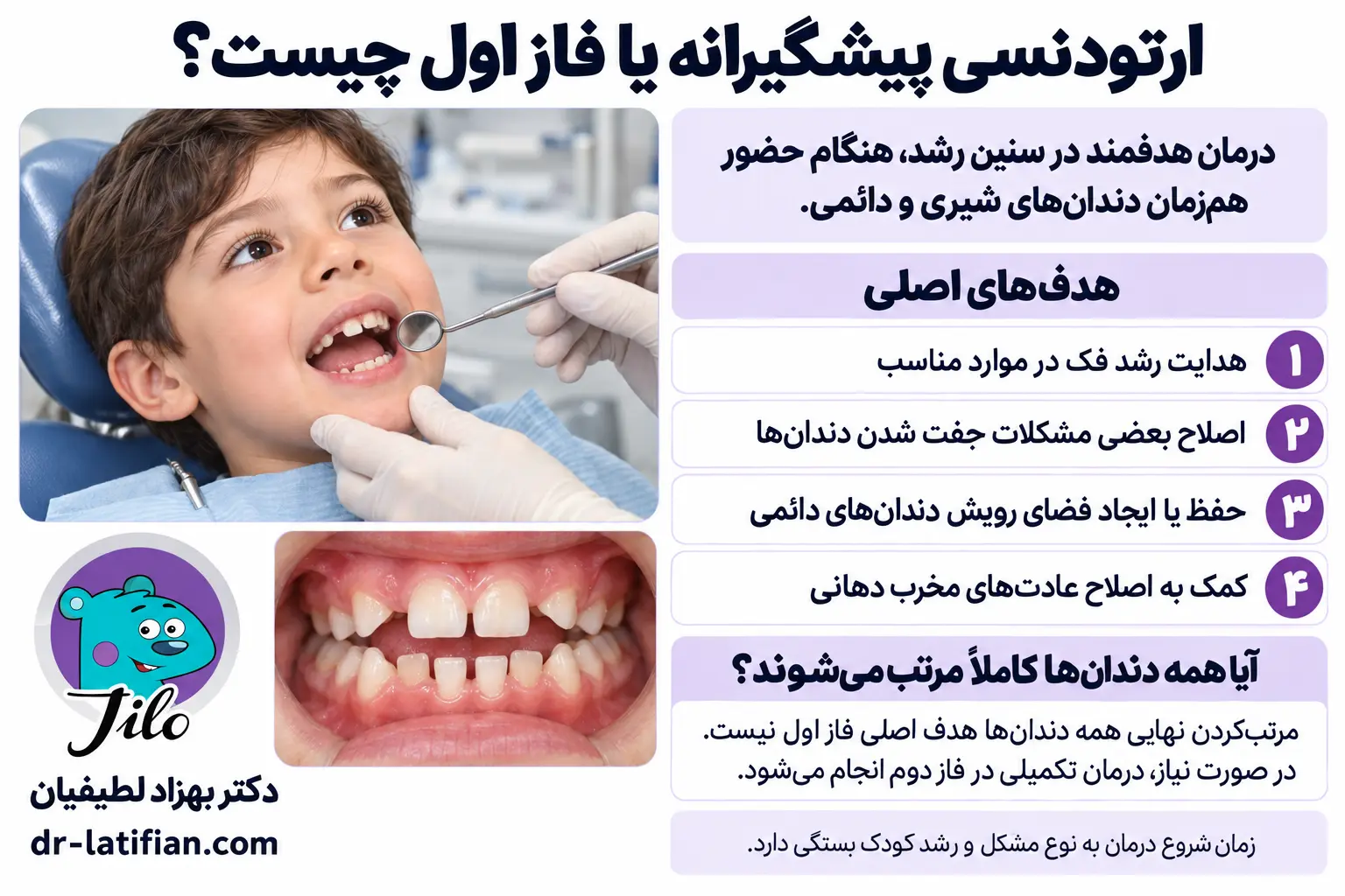 ارتودنسی پیشگیرانه یا فاز اول برای اصلاح رشد فک و ایجاد فضای رویش دندان‌های دائمی کودک